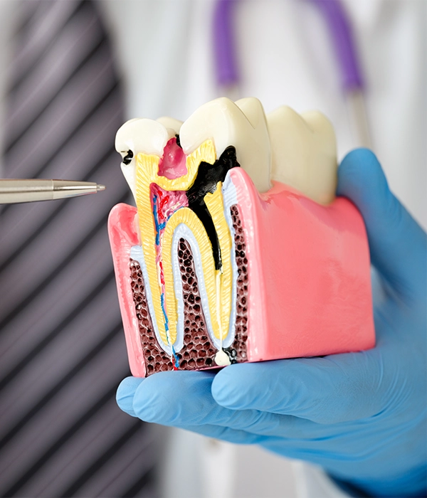 Endodontist Waterville ME Tooth Needing A Root Canal HP